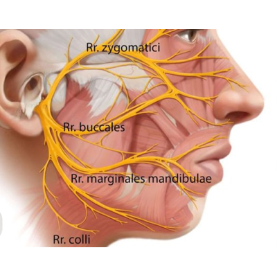 فلج بلز Bells Palsy