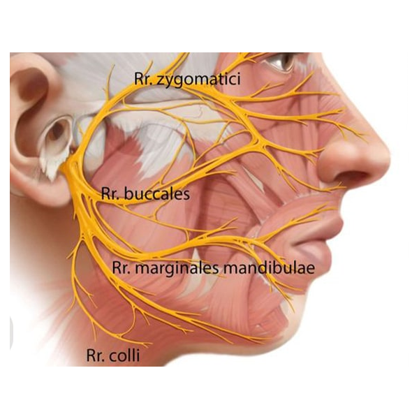 فلج بلز Bells Palsy